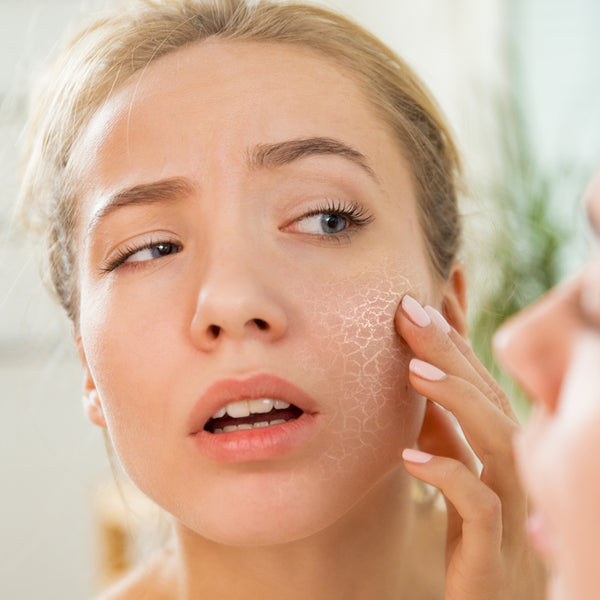 Dry Skin